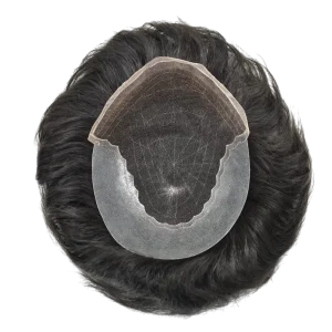 Alın açıklığı kapatılan erkek hastada doğal çizgilere sahip protez saç tasarımı