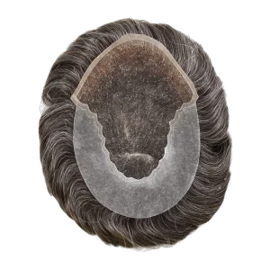 Saç dökülmesi yaşayan genç erkek için protez saç uygulaması sonrası doğal görünüm