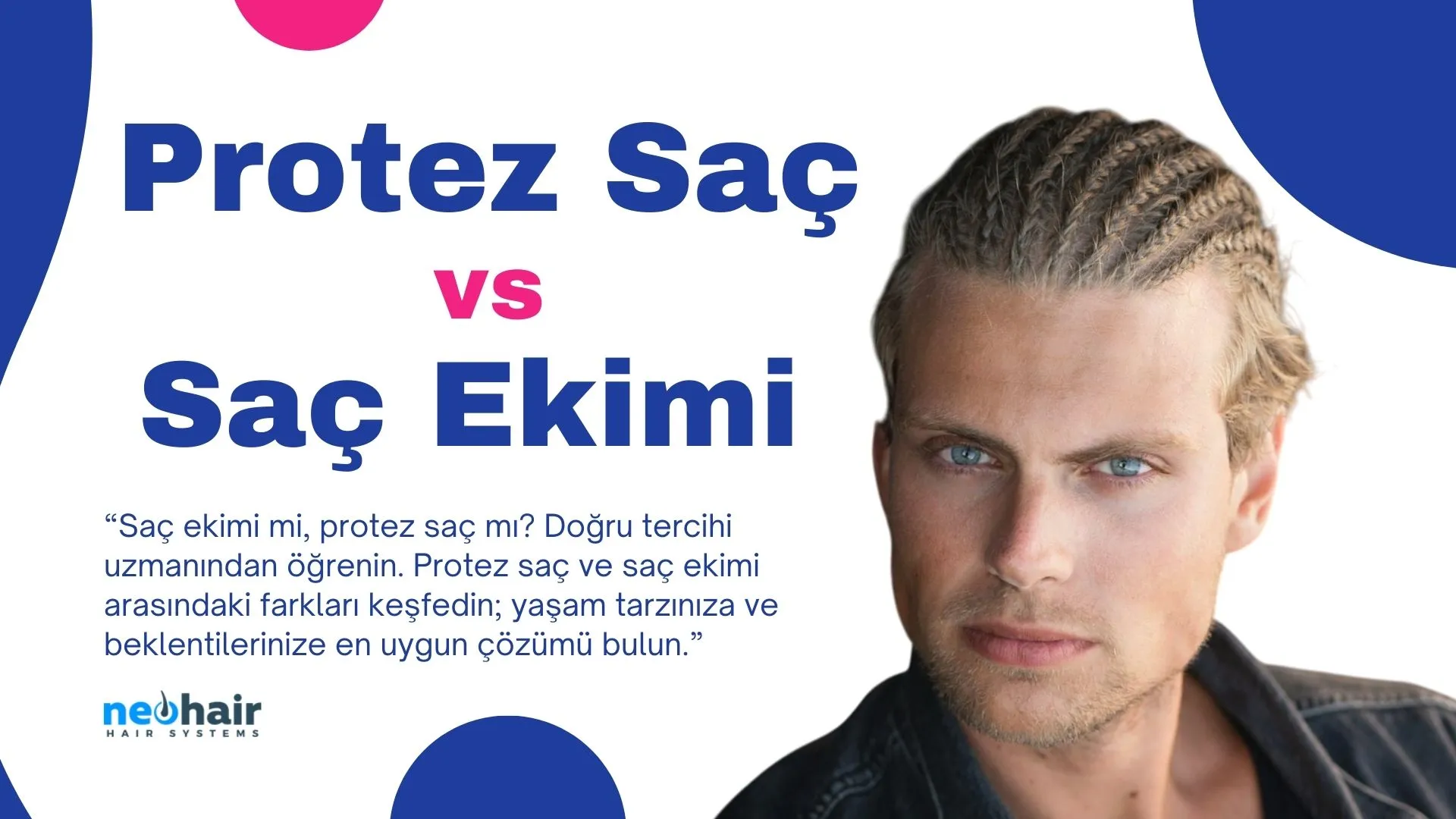 Protez saç mı yoksa saç ekimi mi?