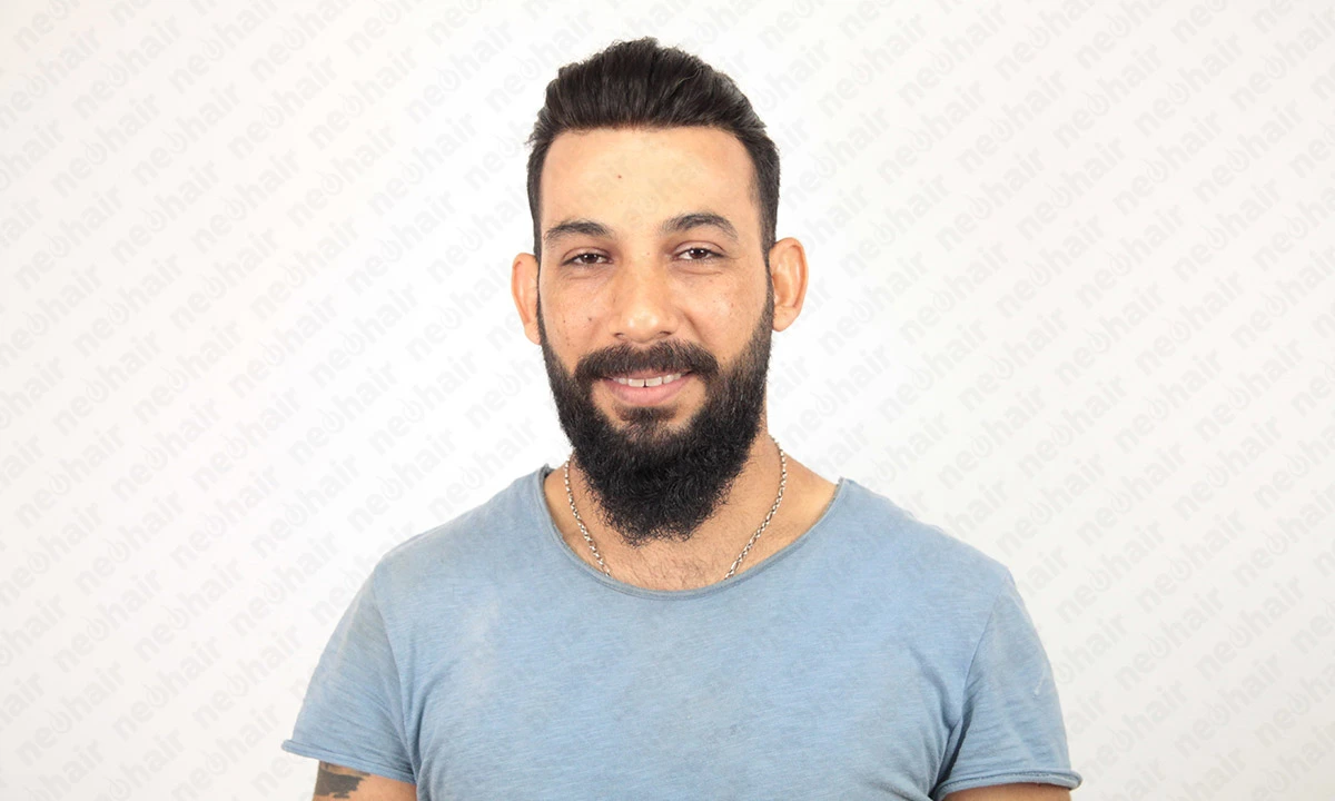 Erkek protez saç modelleri ve trendleri, doğal erkek protez saç kesimleri