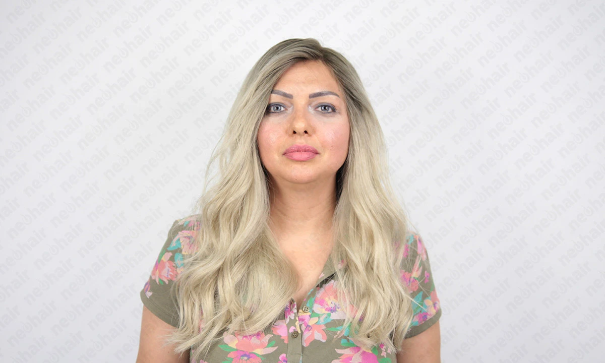 Kadın protez saç modelleri ve trendleri, farklı kadın protez saç kesimleri